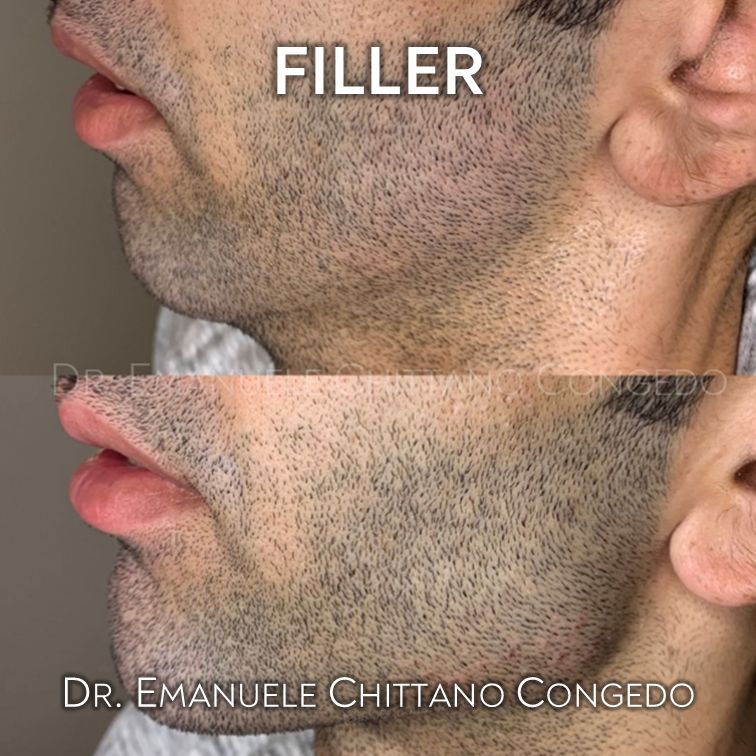 Emanuele Chittano Congedo-15