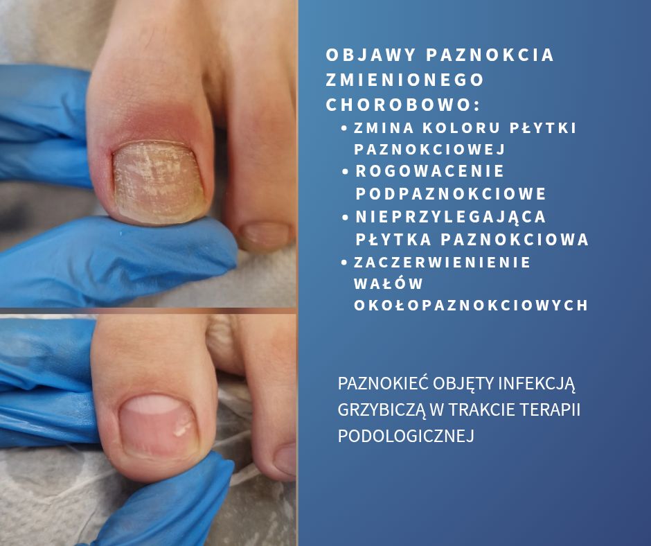 Aleksandra Talarek-2