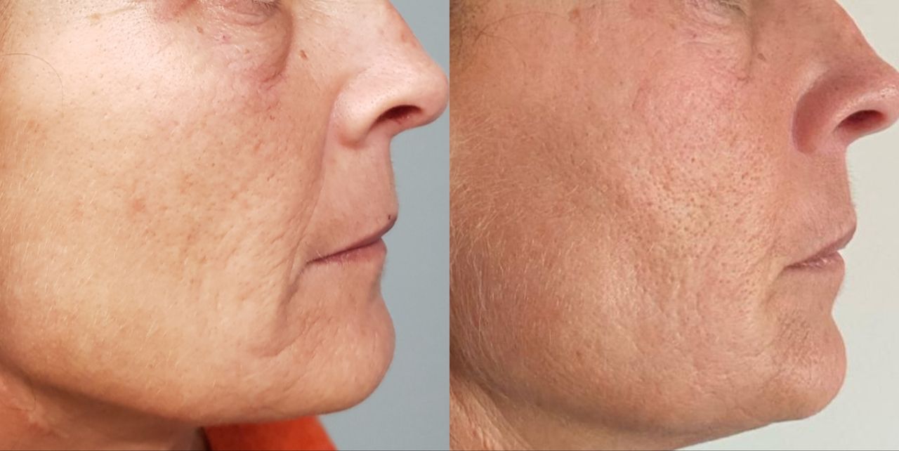 Rosalba Herrero Zerpa-49