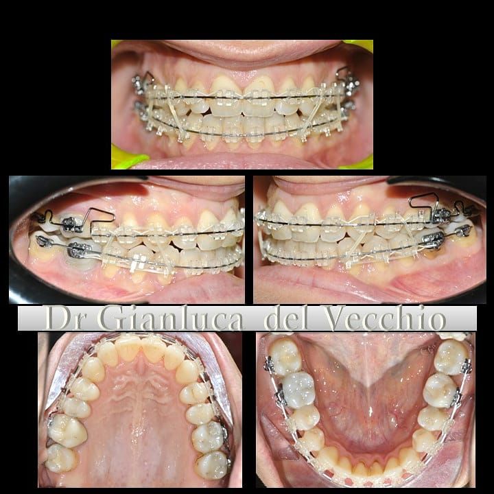 Gianluca Del Vecchio-45