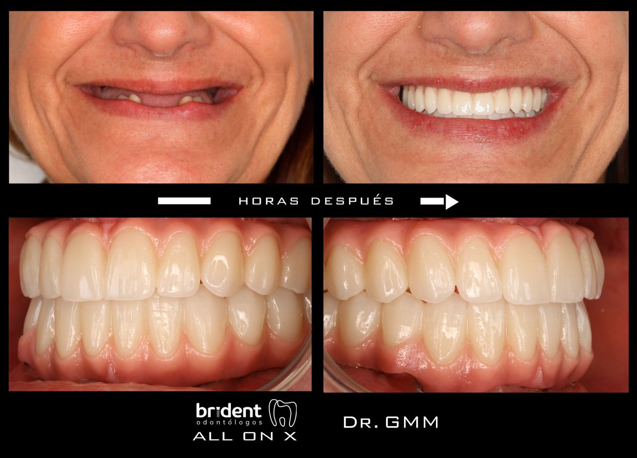 Guillermo Moreno Fragoso-57