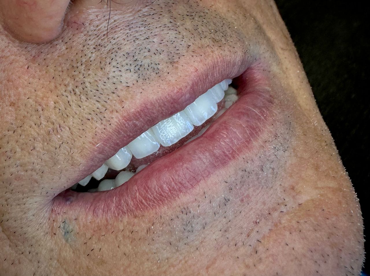 Annibale Donnarumma-3