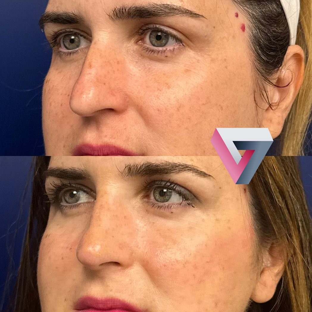 Victoria Trasmonte-94