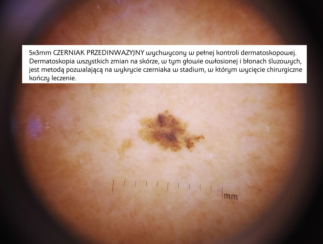 Paweł Pietkiewicz-0