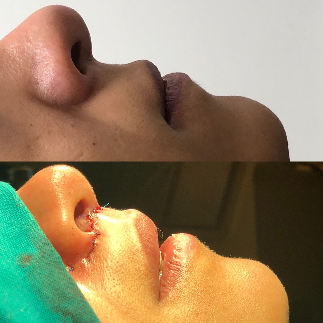 Alberto Candau Álvarez-28