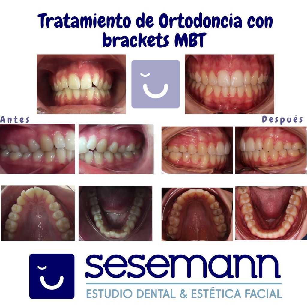 Paula Cano Carrillo-107