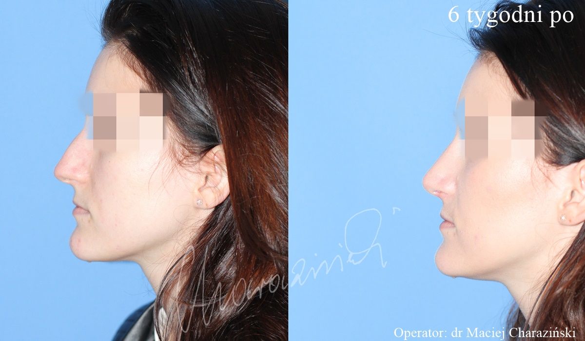 Maciej Charaziński-35