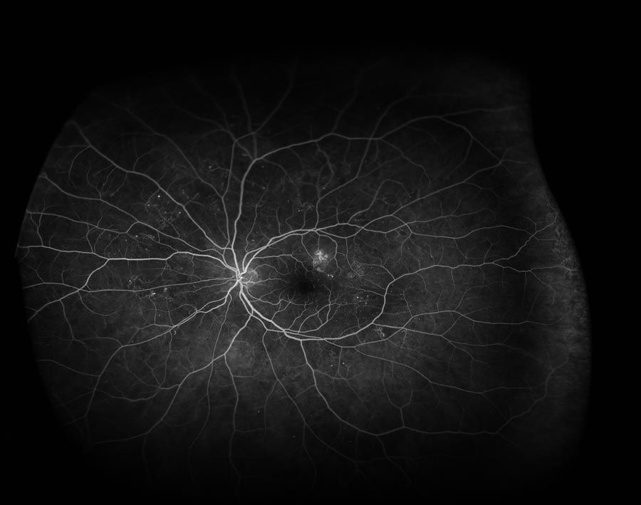 Telmo Xabier Lertxundi Plaza-5