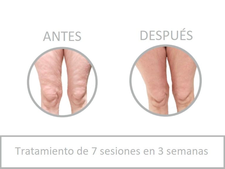 Manuel Hernández Chica-11