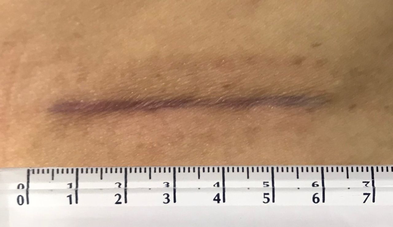 Juan Camilo Hernandez Acevedo-40