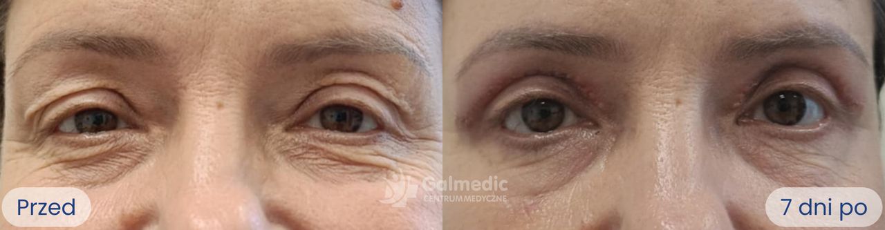 Aneta Michalik-Jakubek-4