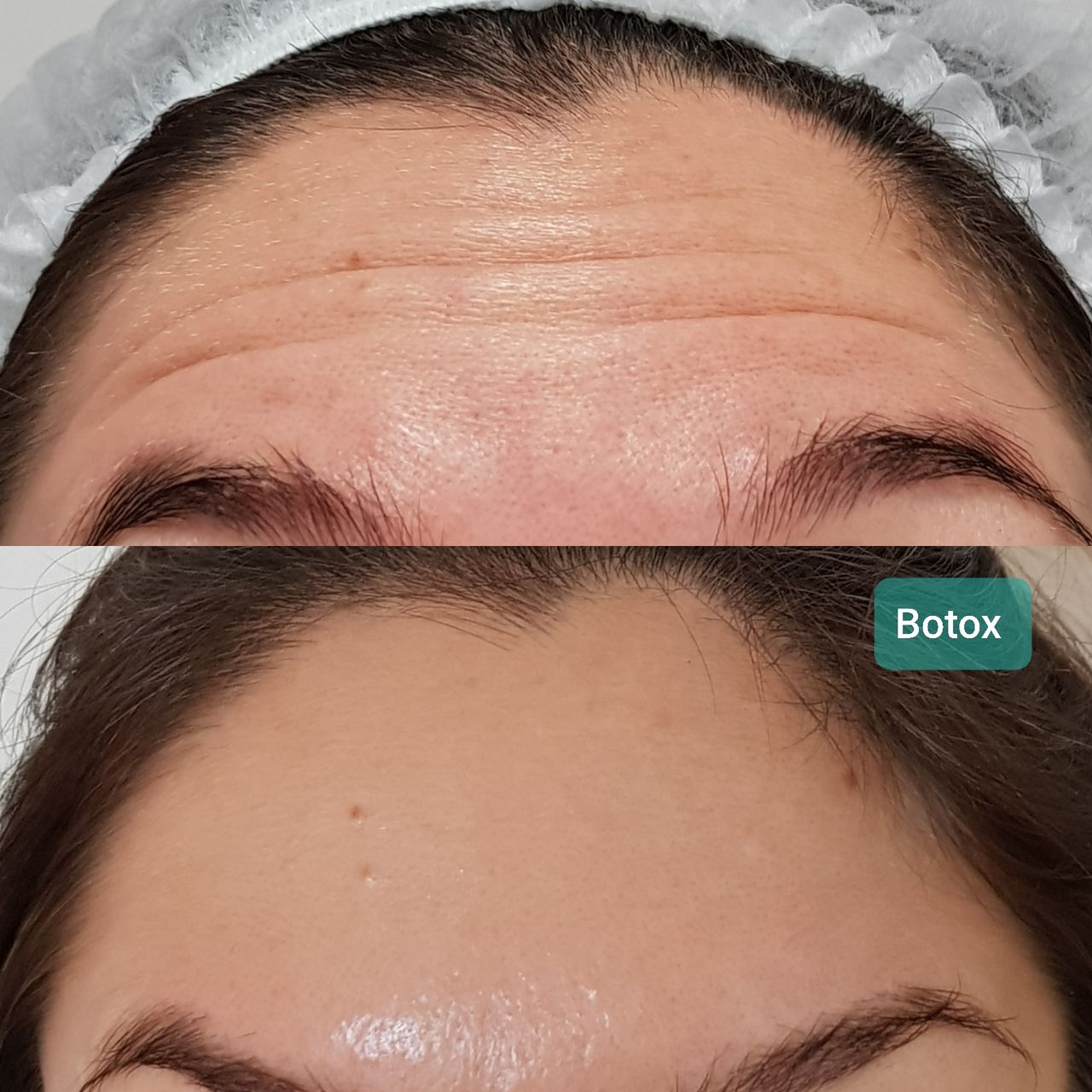 Rosalba Herrero Zerpa-350