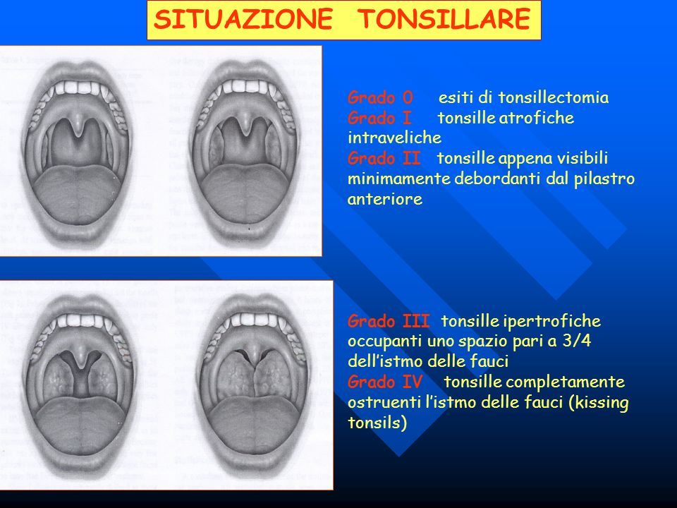 Donatella Marchese-9