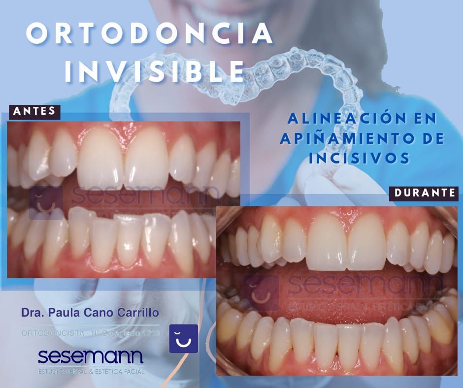 Paula Cano Carrillo-15