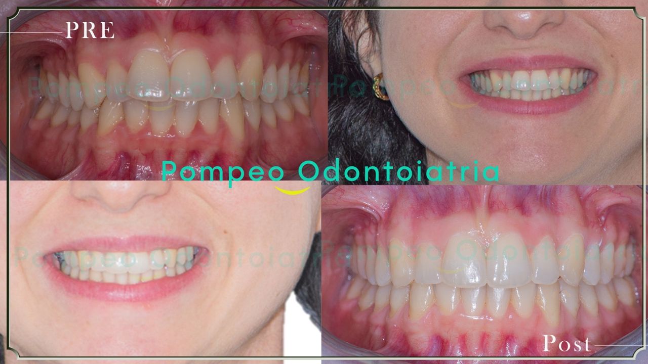 Enrico Maria Pompeo-3