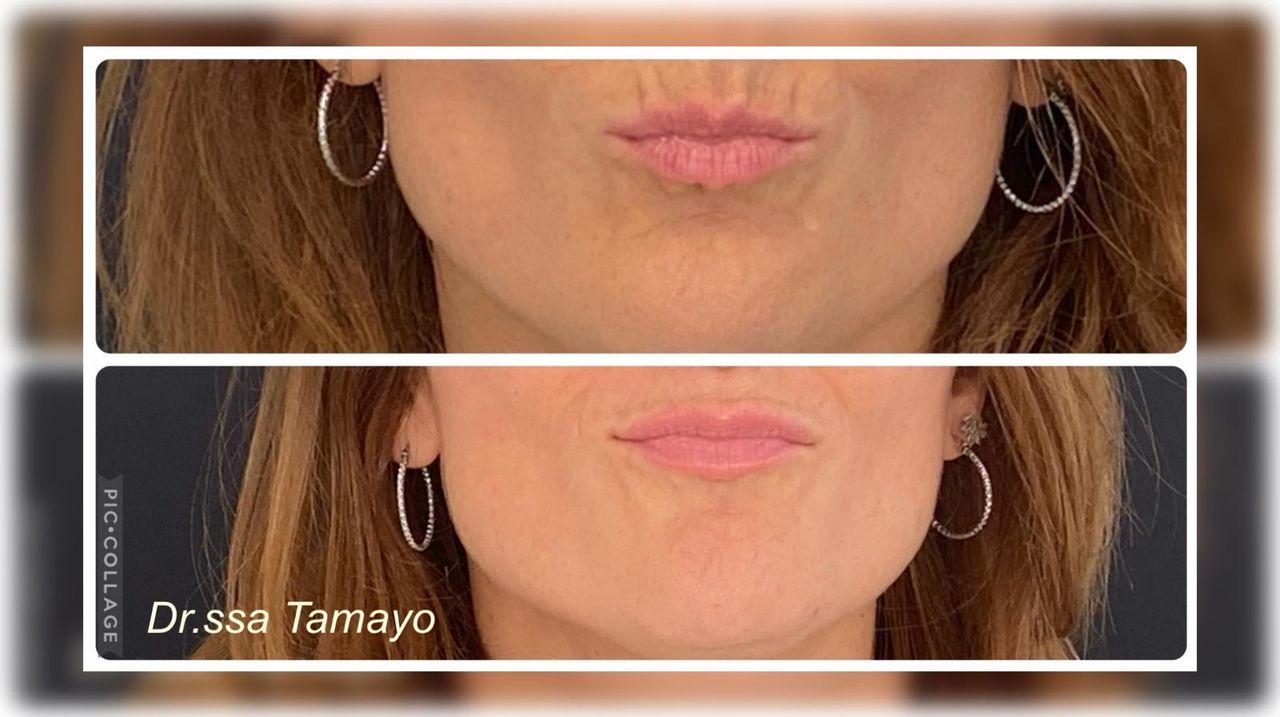 Lazara Dianelys Tamayo-6