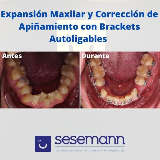 Paula Cano Carrillo-40