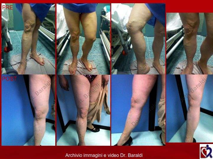 Christian Baraldi-16