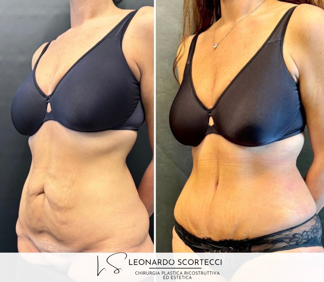 Leonardo Scortecci-5