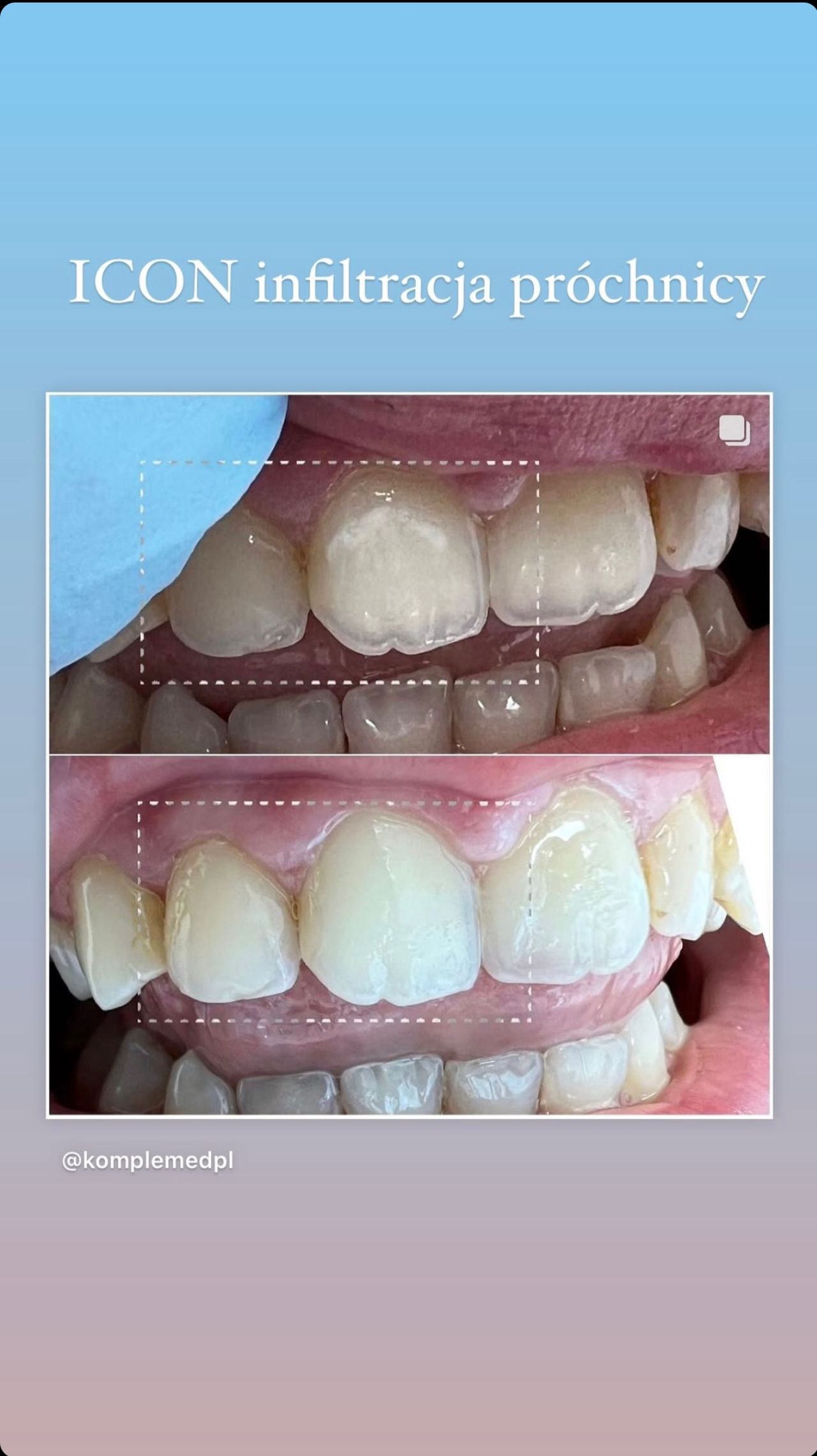 Oleksandra Chernykh-11