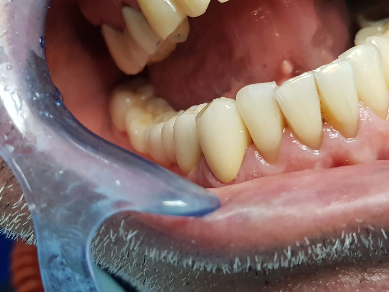 Stefano De Simone-96