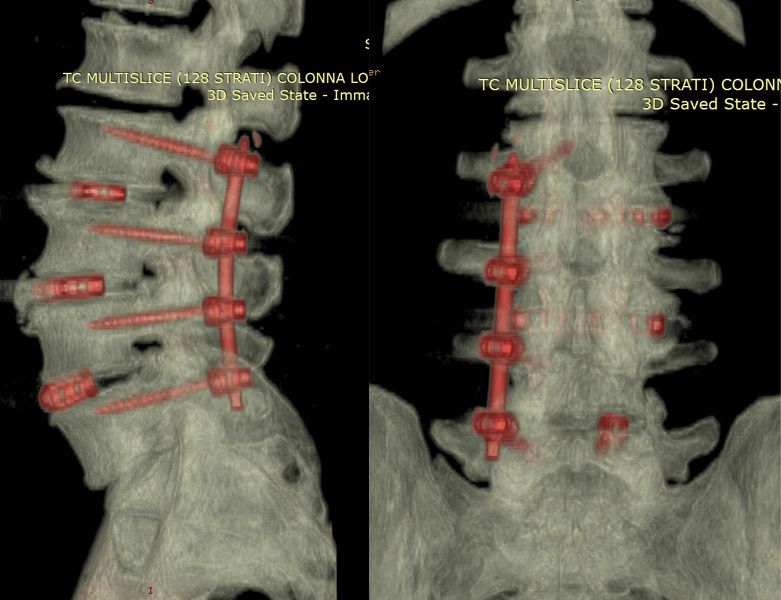 Massimiliano Neroni-13