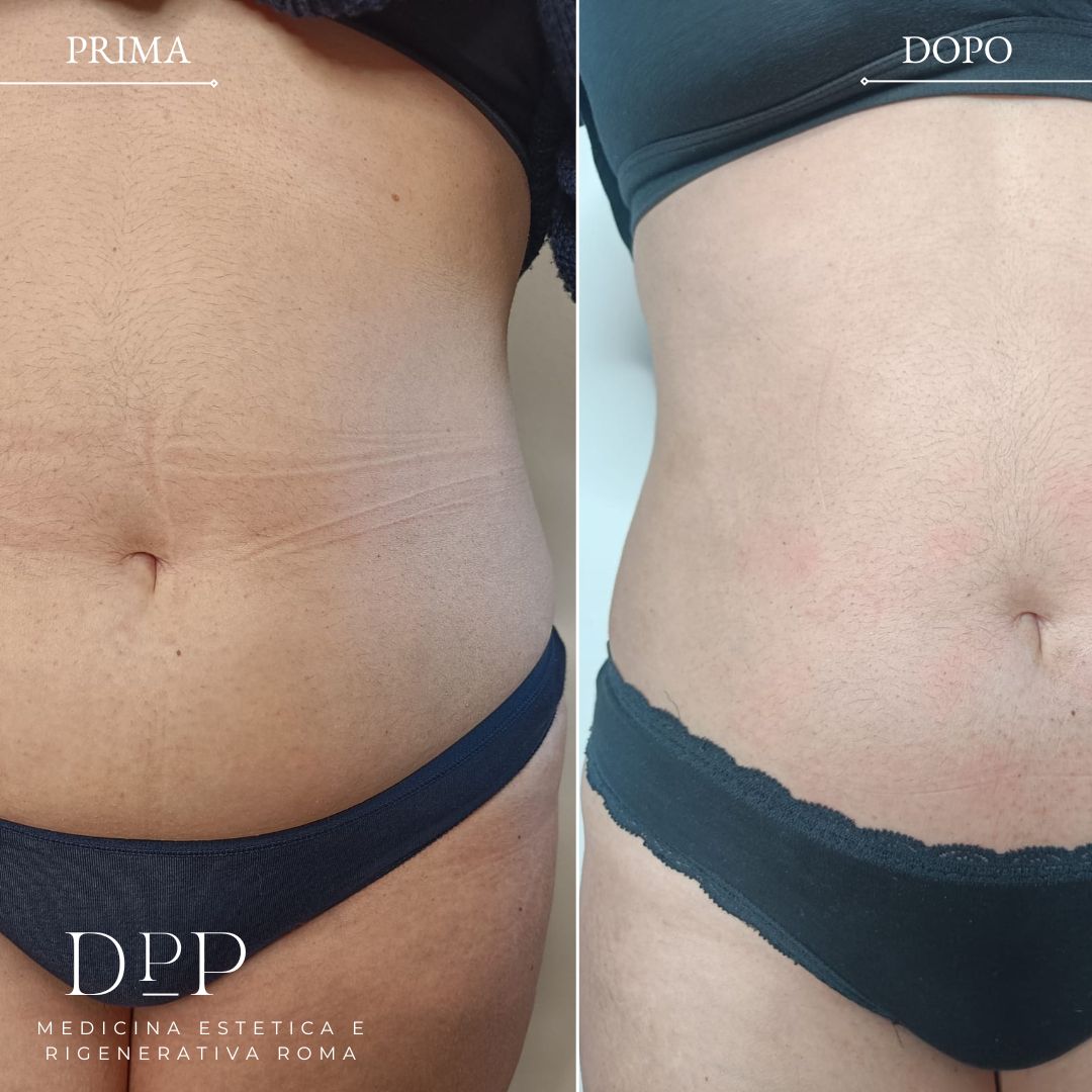 Davide Prosperi Porta-14