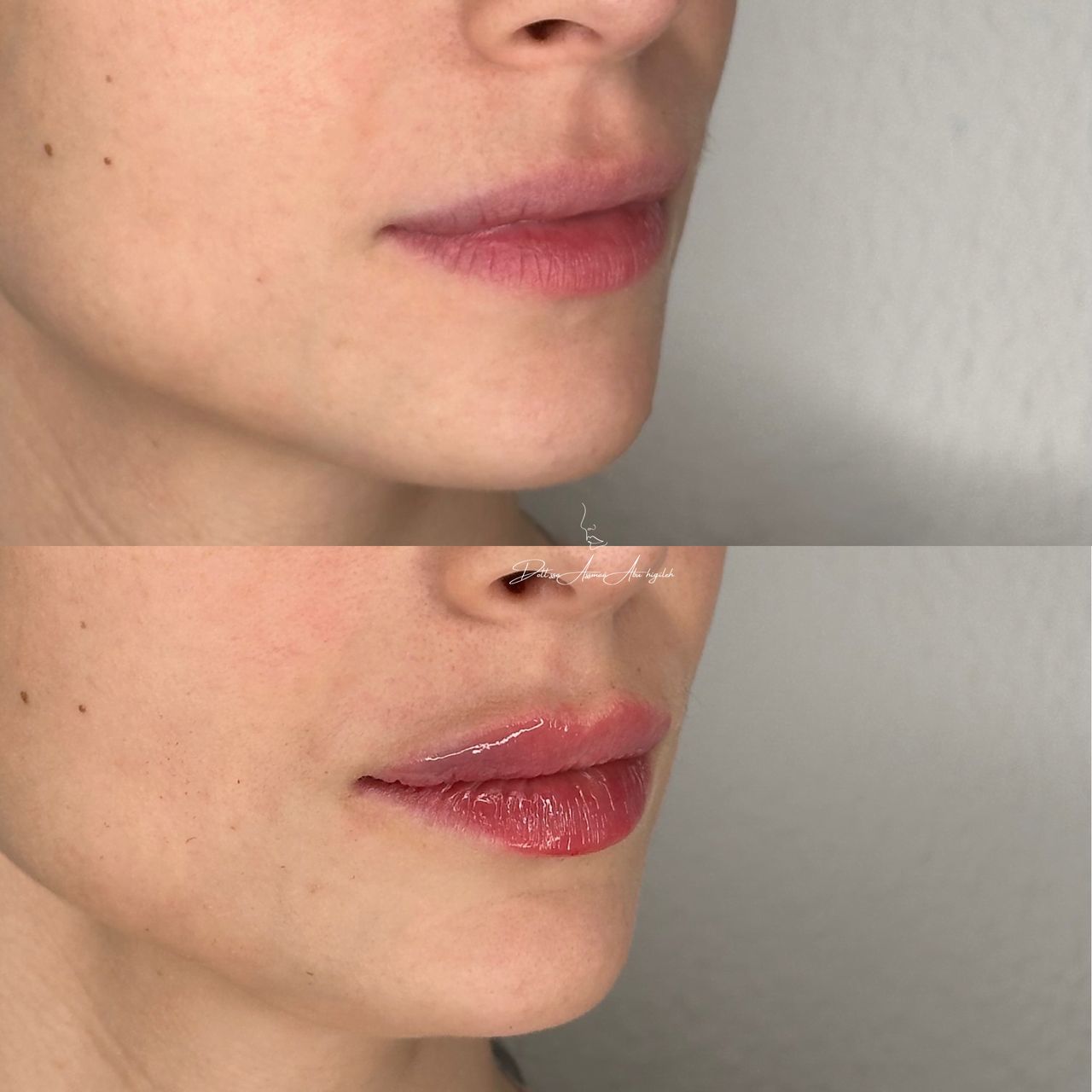 Assmaà Abu Higileh-7