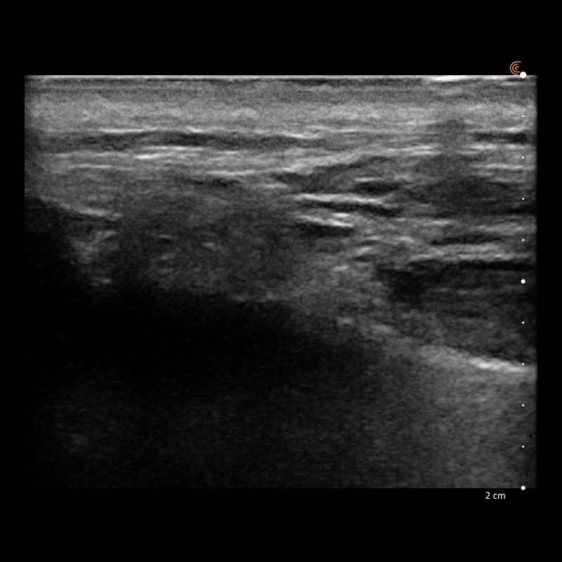 Aleksandra  Plata-Babula-11