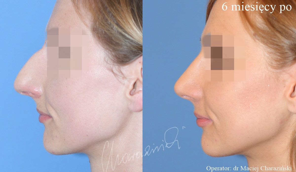 Maciej Charaziński-12