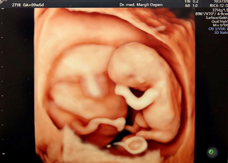 Margit Oepen - Privatpraxis-3