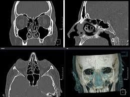 Massimiliano Sperandio-5
