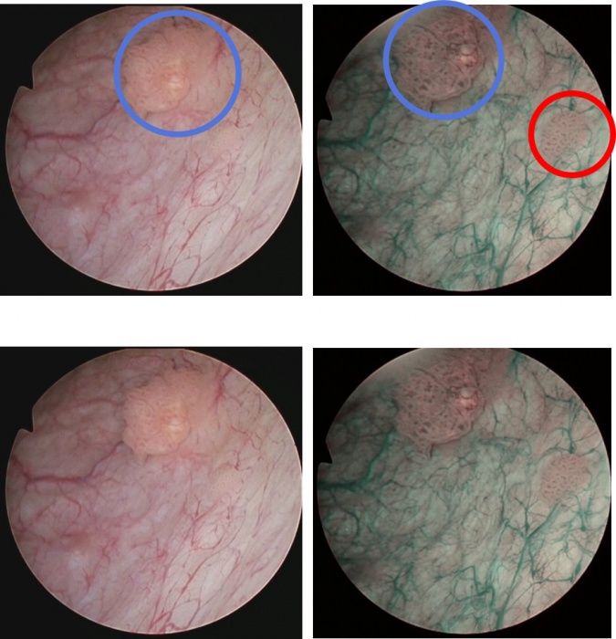 Hannes-Dietrich Höfer-1