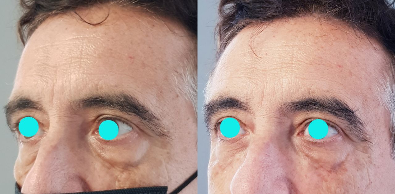 Rosalba Herrero Zerpa-126