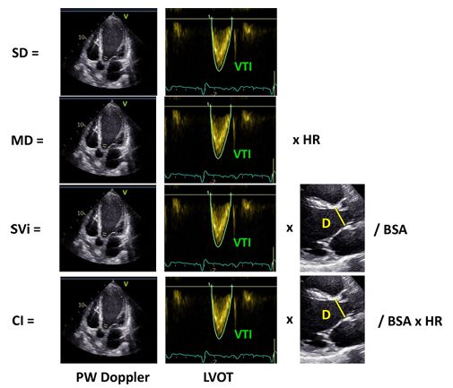 Giovanni Andrea Luisi-1