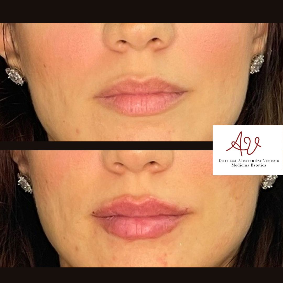 Alessandra Venezia-15