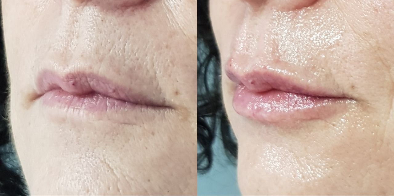 Rosalba Herrero Zerpa-56