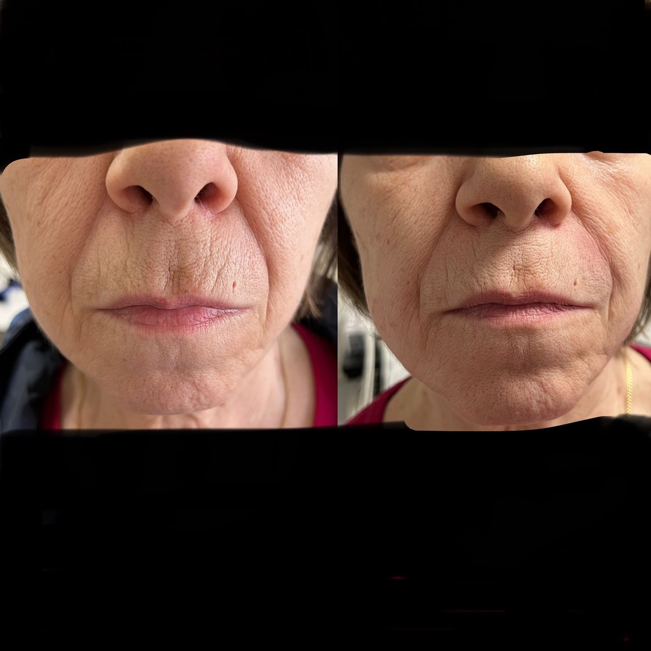 Jacopo Pettinelli-48