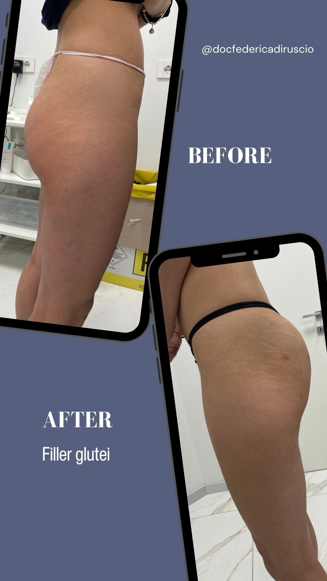 Federica Di Ruscio-6