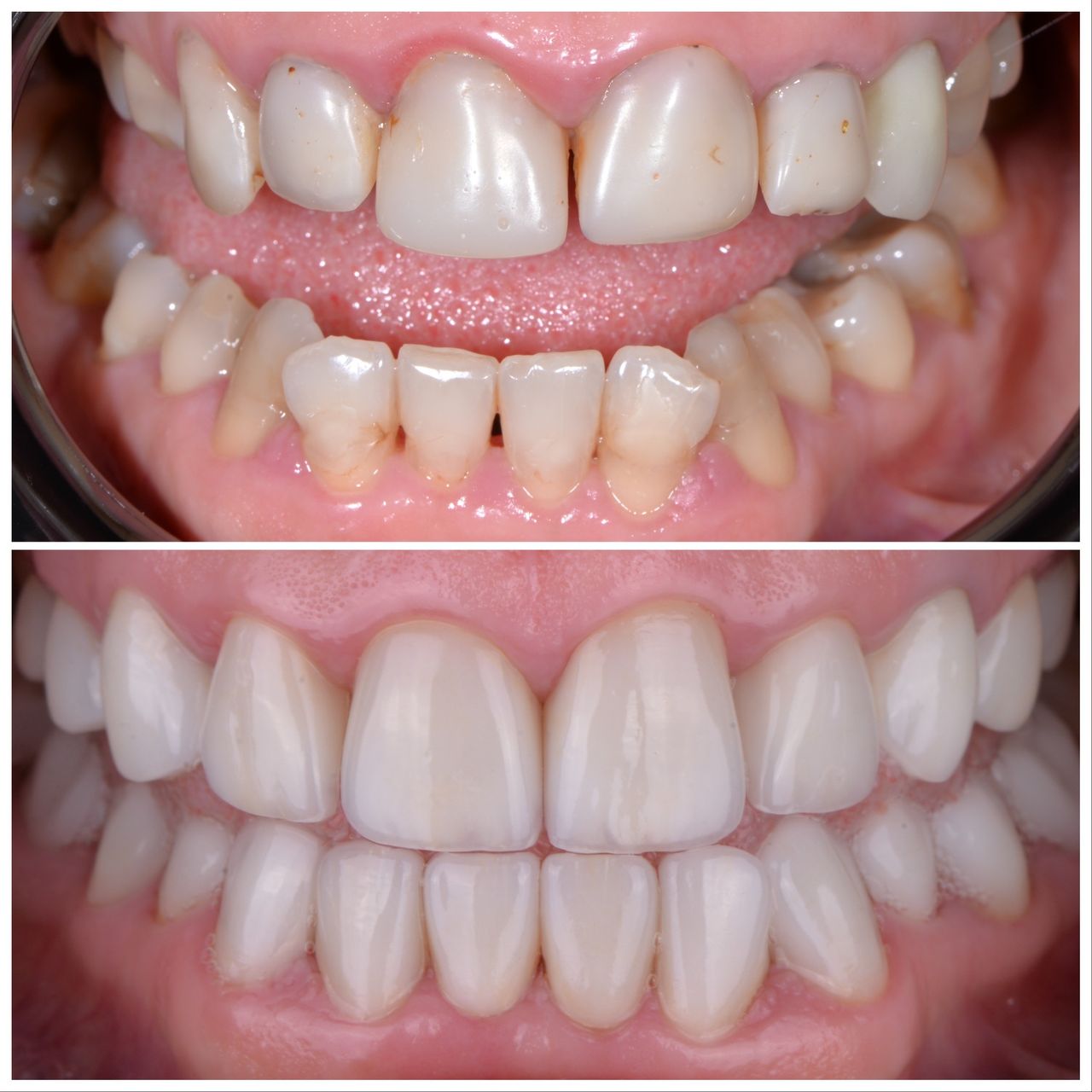 Martin Bartoszcze-21