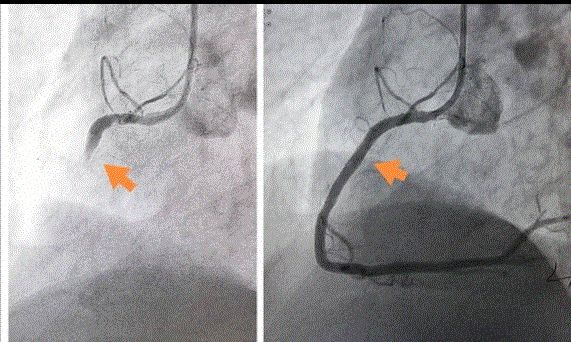 Hüseyin Onur Şahin-13