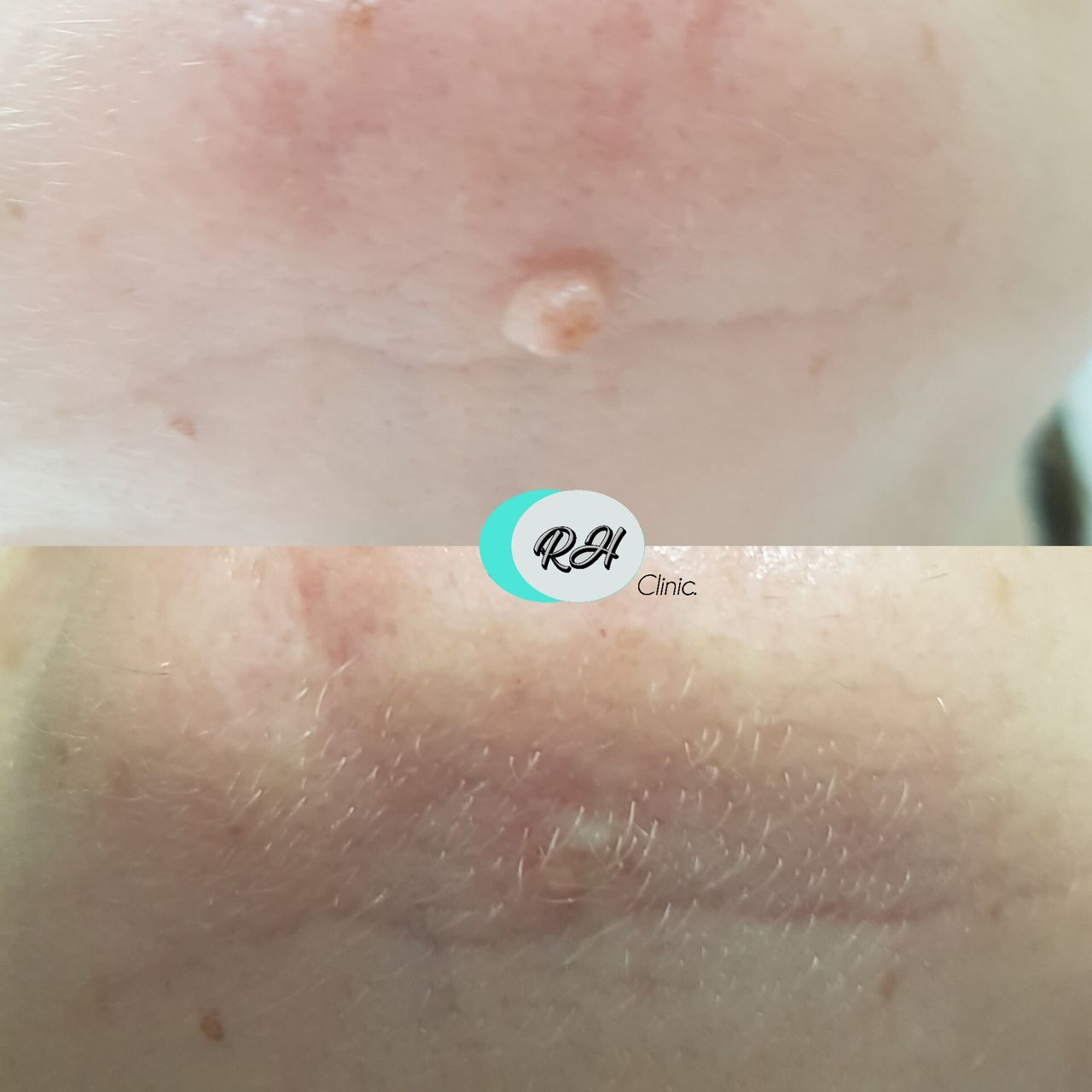 Rosalba Herrero Zerpa-598