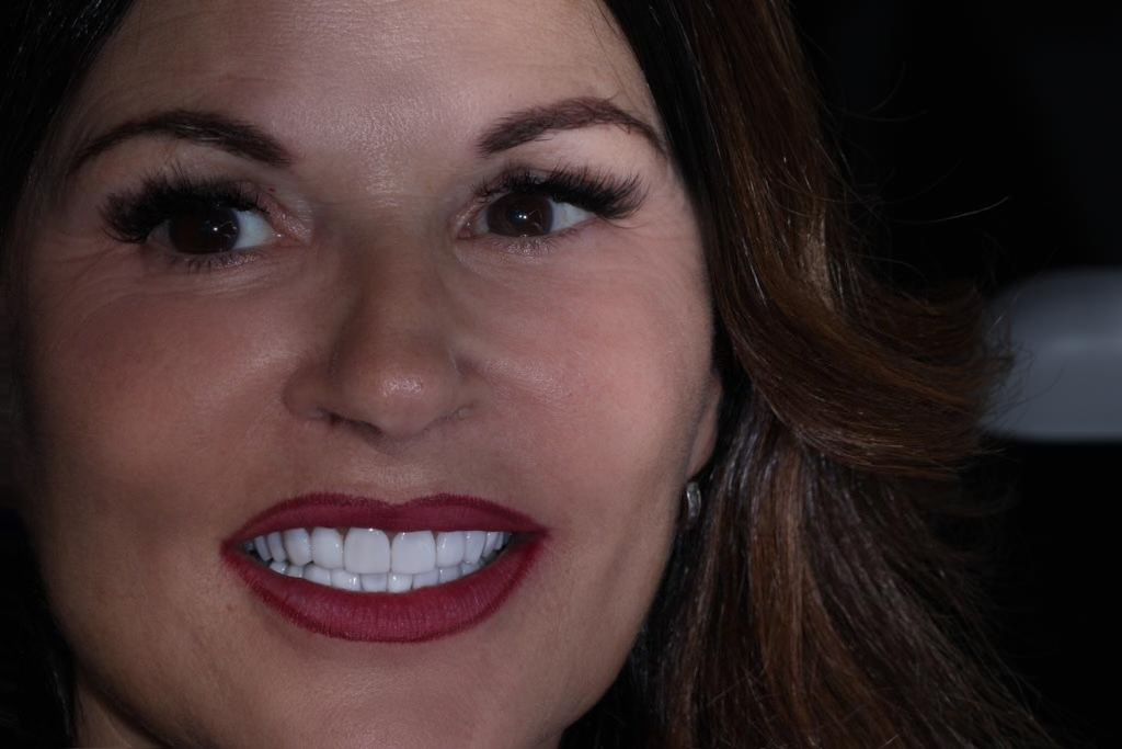 Ruben Patier Martin-15