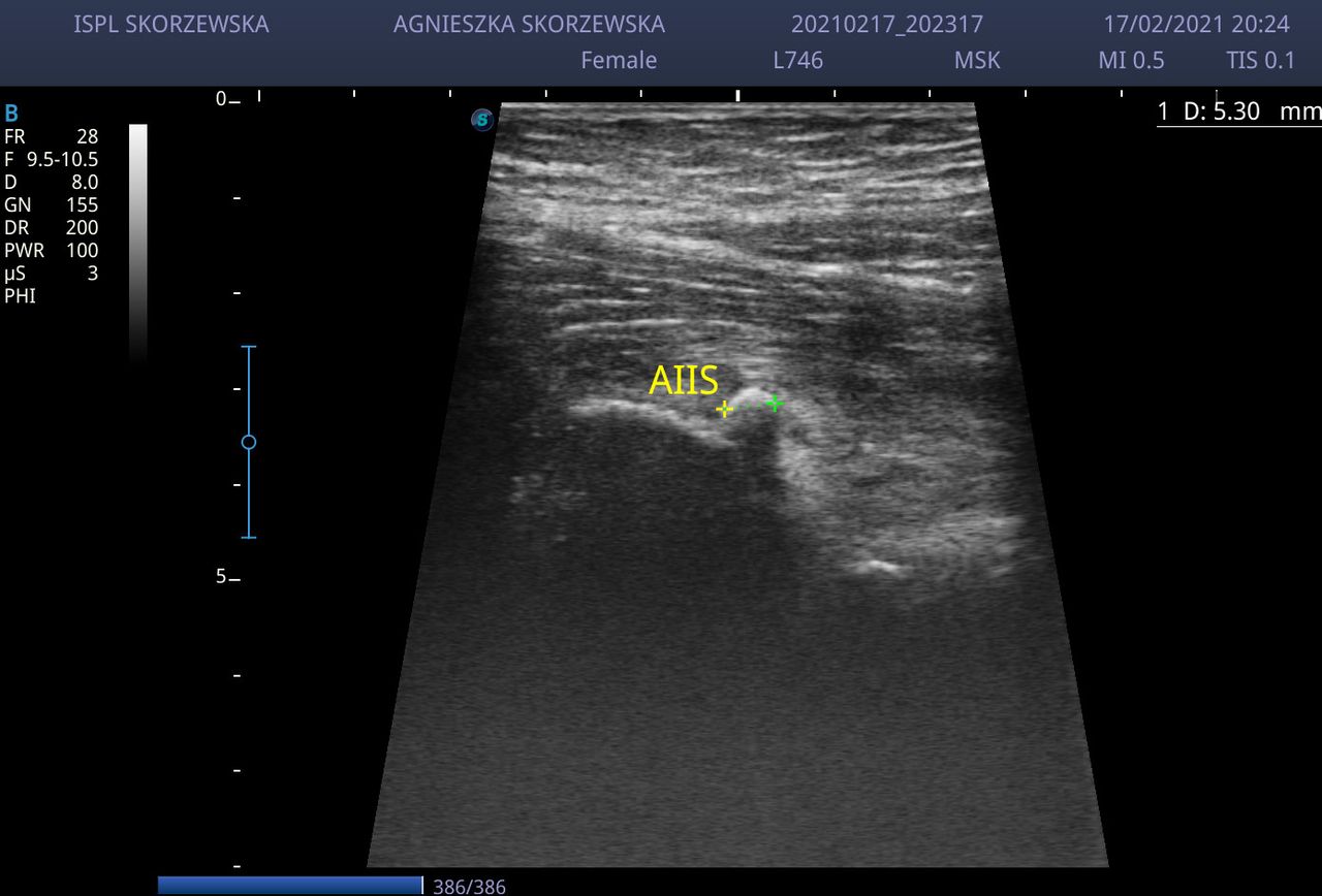 Agnieszka Skórzewska-2