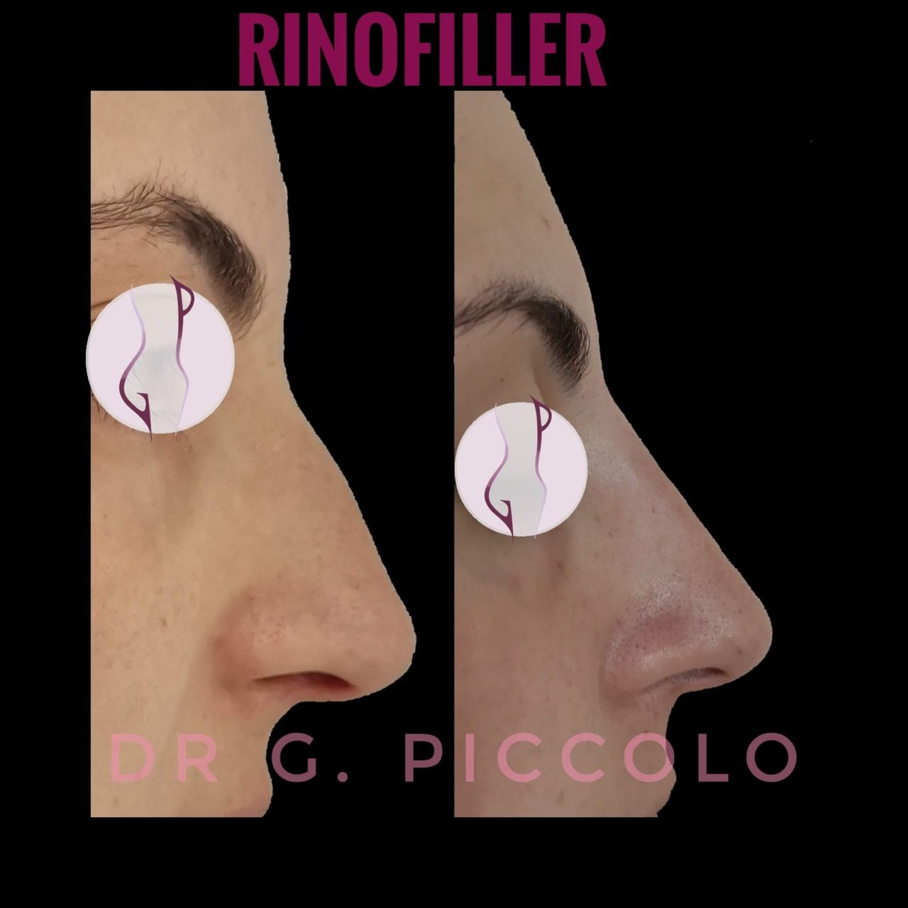 Giuseppina Piccolo-47