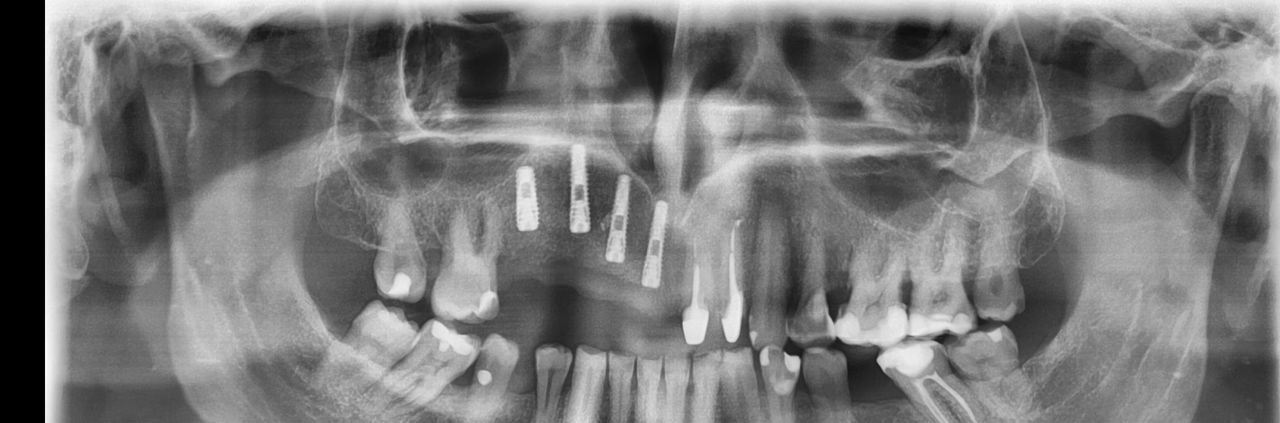 Wojciech Goździewicz-7