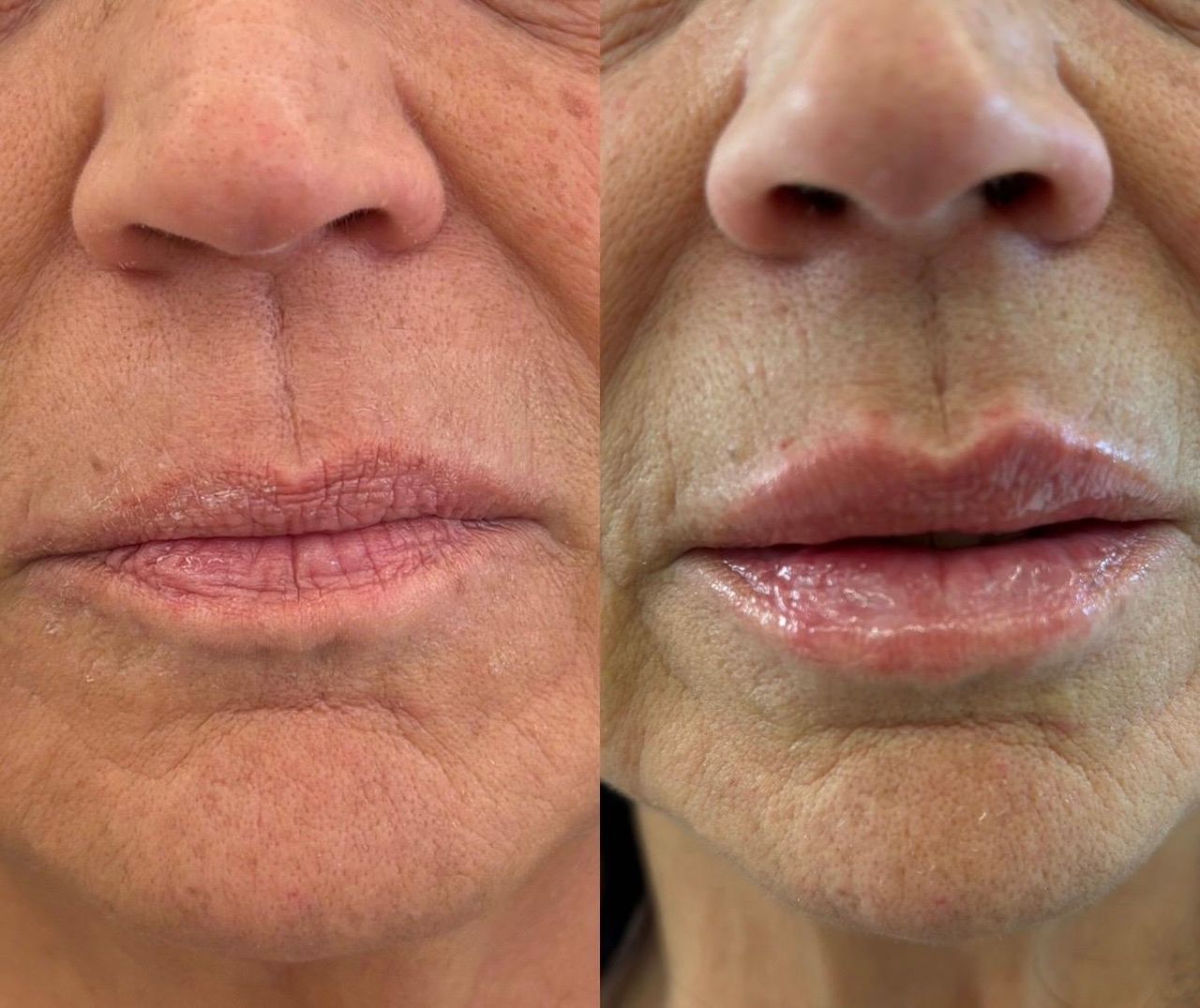 Alessandra Simonitto-4