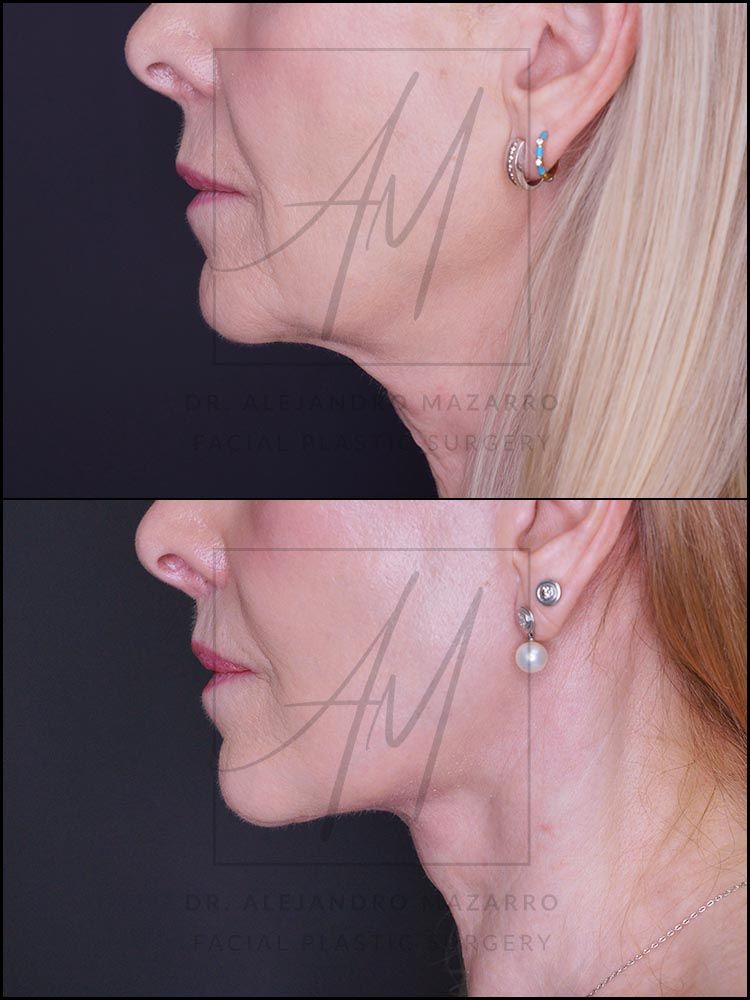 Alejandro Mazarro Campos-3