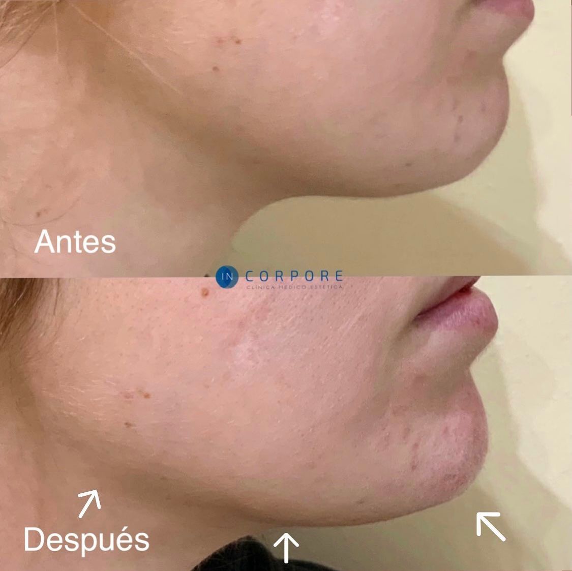 Juan Enrique Pérez Enríquez-9