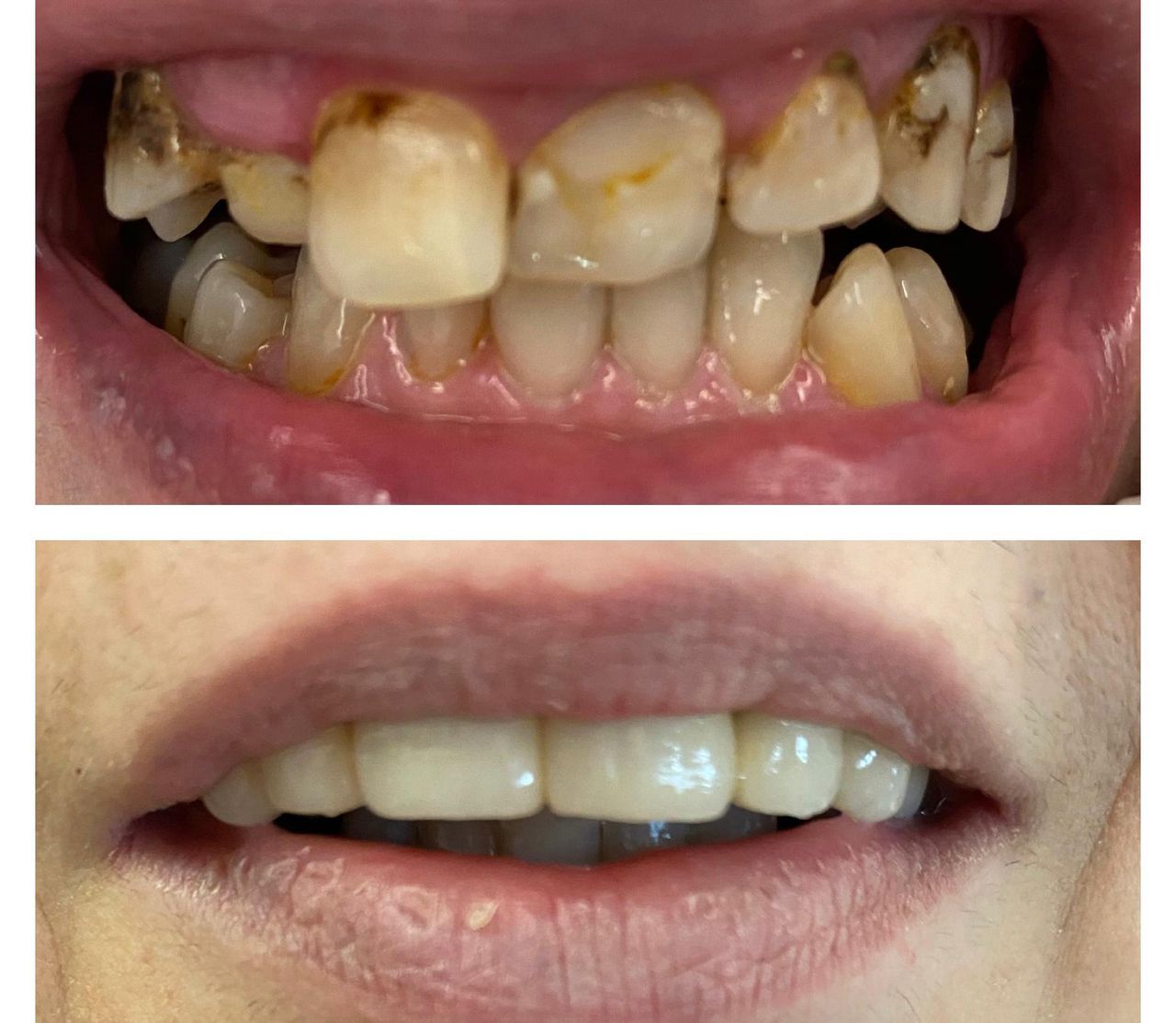 Federica Del Villano-8